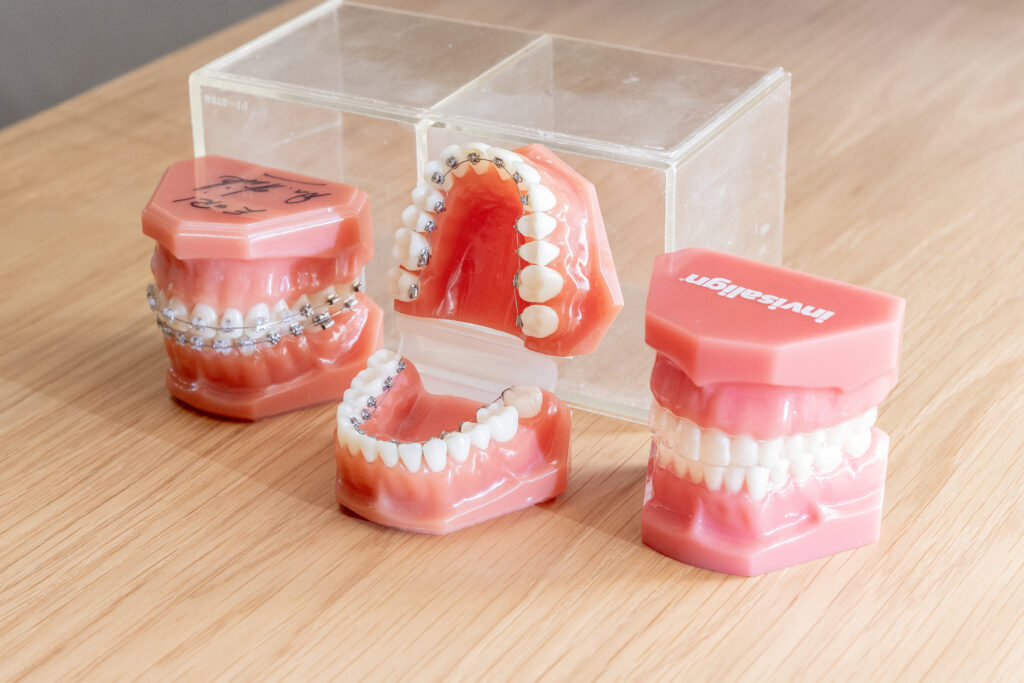 装置の種類。裏側矯正,舌側矯正,表側矯正,マウスピース