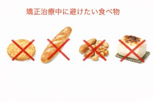 矯正治療中にさけたい食べ物