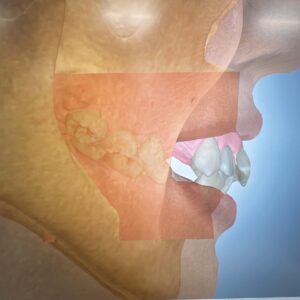 フェイシャルスキャナー